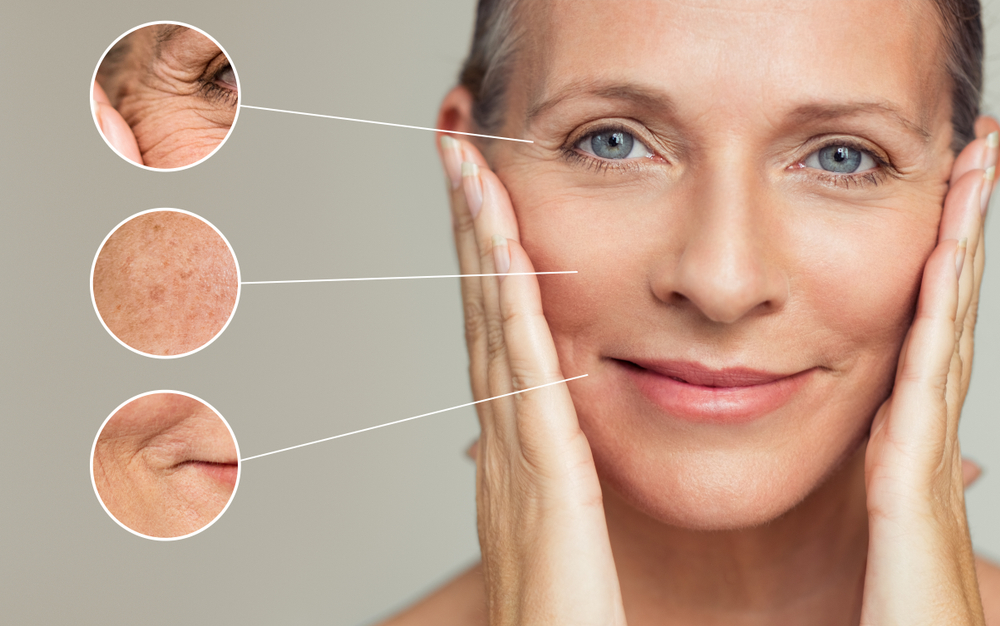 Close,Ups,Of,Wrinkles,And,Skin,Imperfection,On,The,Face